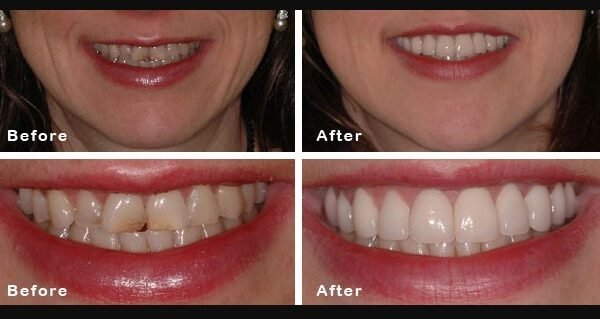 Dr. Prashant Gupta is one of the best Cosmetic Dentistry in Pune