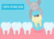 Emergency Tooth Extraction: What You Need to Know