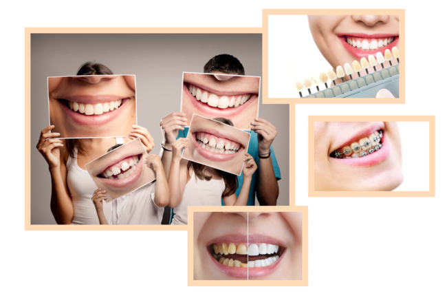 Best Dentist in Pune for All Your Dental Problems at Braces & Smiles