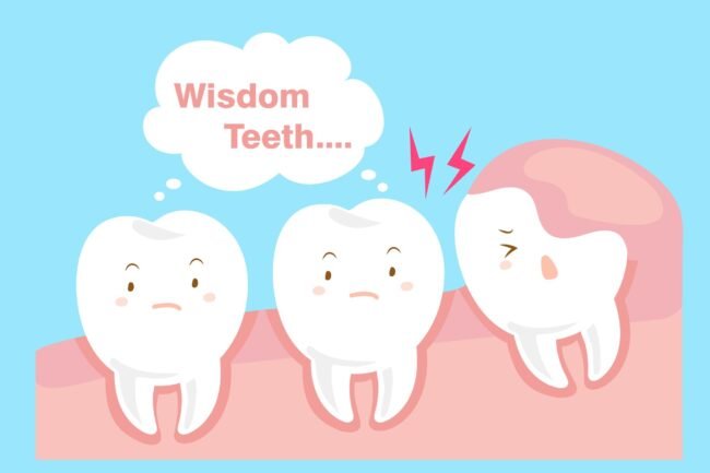Are You Troubled With Your Wisdom Tooth? Find Best Dentist near you