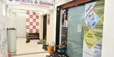 Discover exceptional dental care in Pune at Braces and Smile Dental Clinic! Trust us to brighten your smile and enhance your oral health.