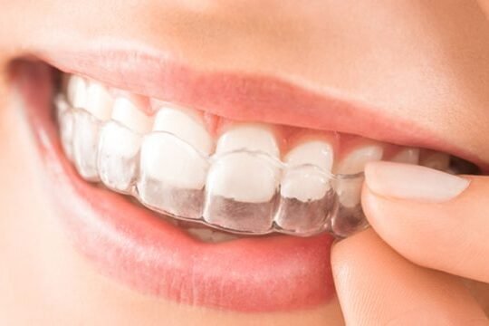Advantages of Enhancing Teeth Alignment Through Orthodontic Treatment in Pune
