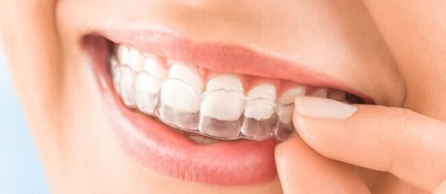 Modern-Ways-To-Align-Your-Teeth-Cover Advantages of Enhancing Teeth Alignment Through Orthodontic Treatment in Pune