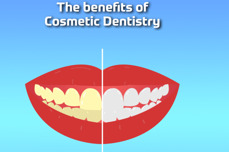 The Benefits of Cosmetic Dentistry