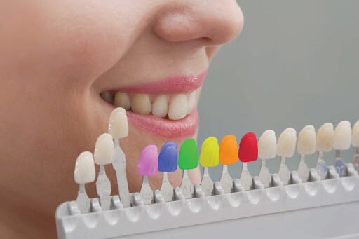 tooth-colored fillings tooth-colored fillings