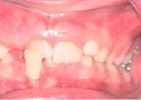 Before2 (1) Before2 (1)