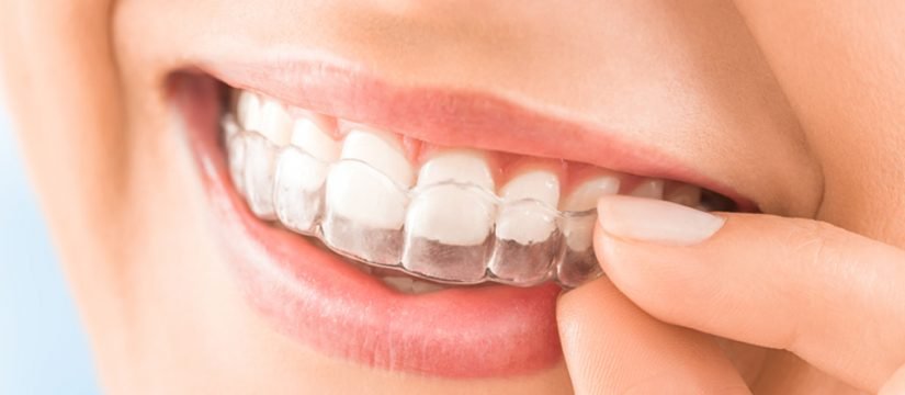 Advantages of Enhancing Teeth Alignment Through Orthodontic Treatment in Pune