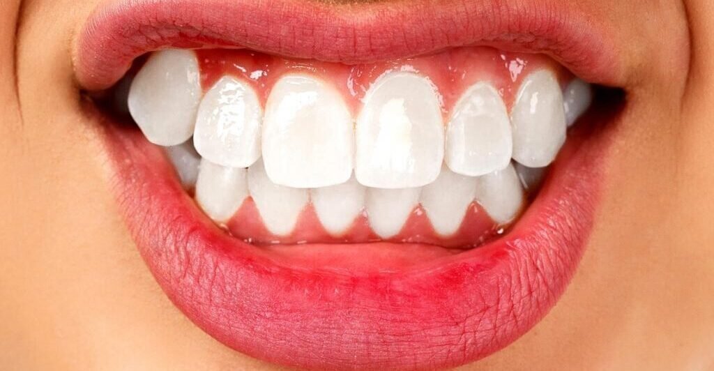 Breaking the Cycle: Effective Treatments for Teeth Clenching Habit.