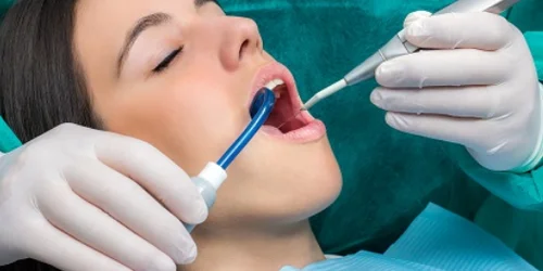 Comprehensive Gum Care – The Best Dentist in Kalyani Nagar
