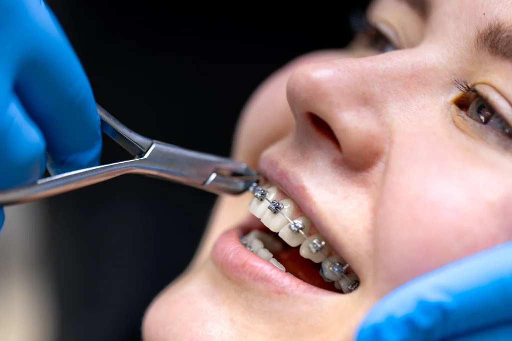 Find Best Orthodontist in Pune Kalyani Nagar
